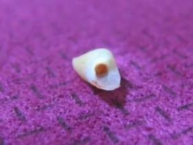 做梦梦到牙齿掉了是什么意思